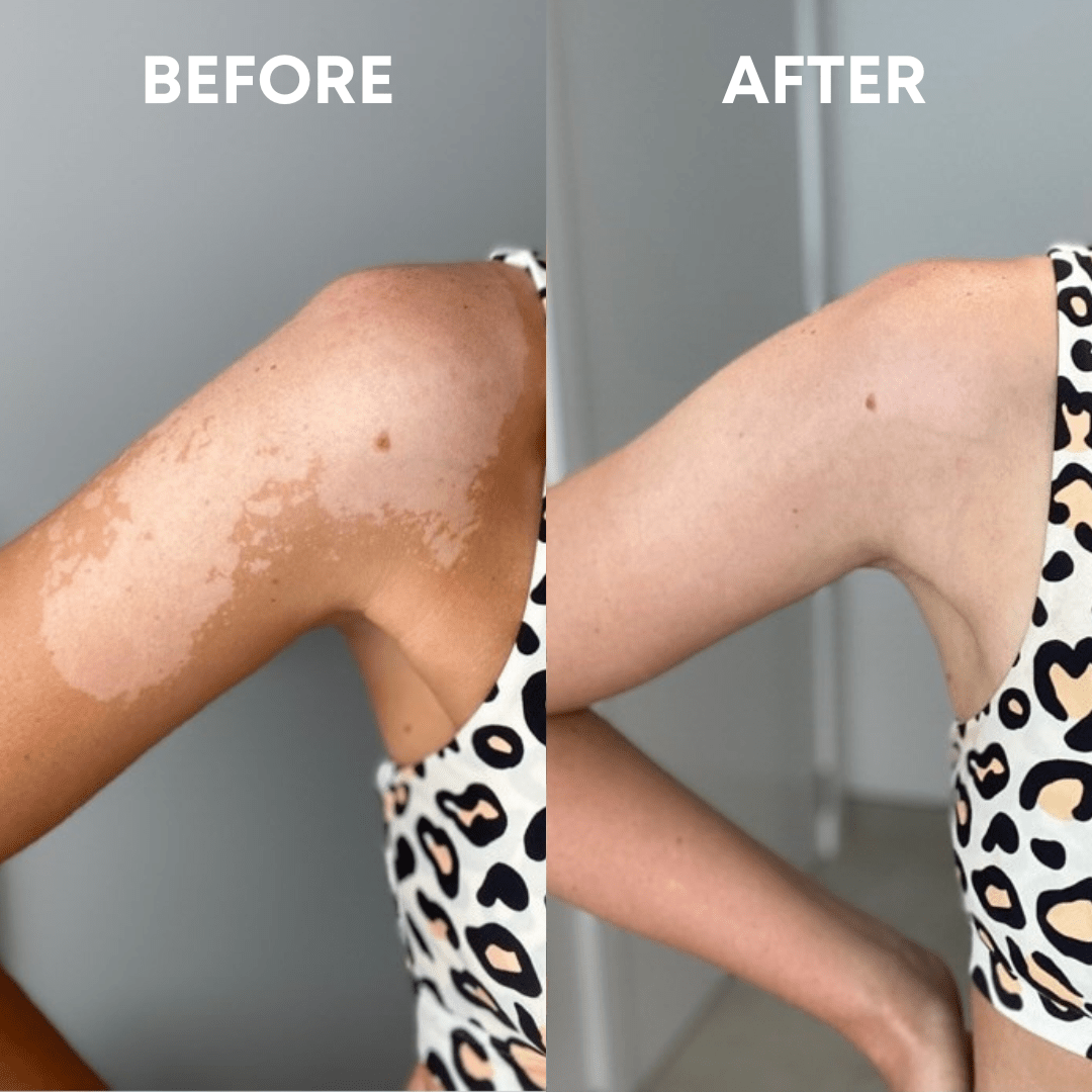 Body Exfoliating Glove